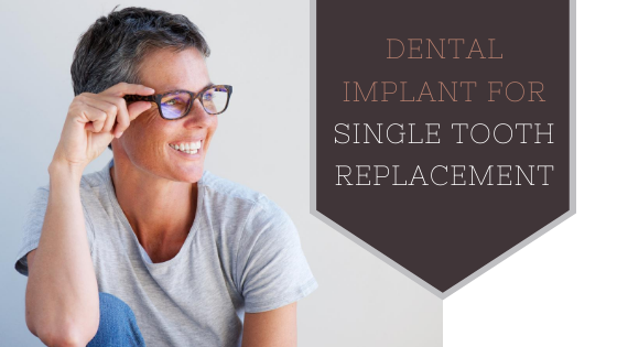 Read more about the article Why a Dental Implant for a Single Tooth Replacement?