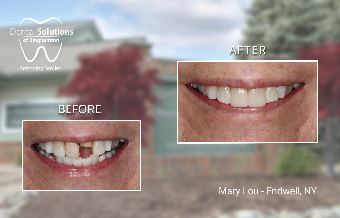 Restorative Dentistry Vestal, NY